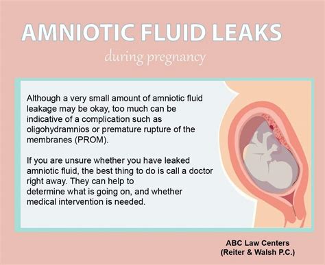 amniotic.fluid leaking|Leaking Amniotic Fluid: How to Tell